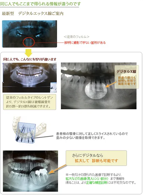 歯科用CT